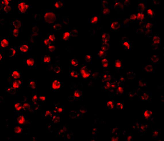 Immunocytochemistry/ Immunofluorescence: ATF6 Antibody - BSA Free [NBP1-76675] - Immunofluorescence of ATF6 in MCF7 cells with ATF6 antibody at 10 u/mL.