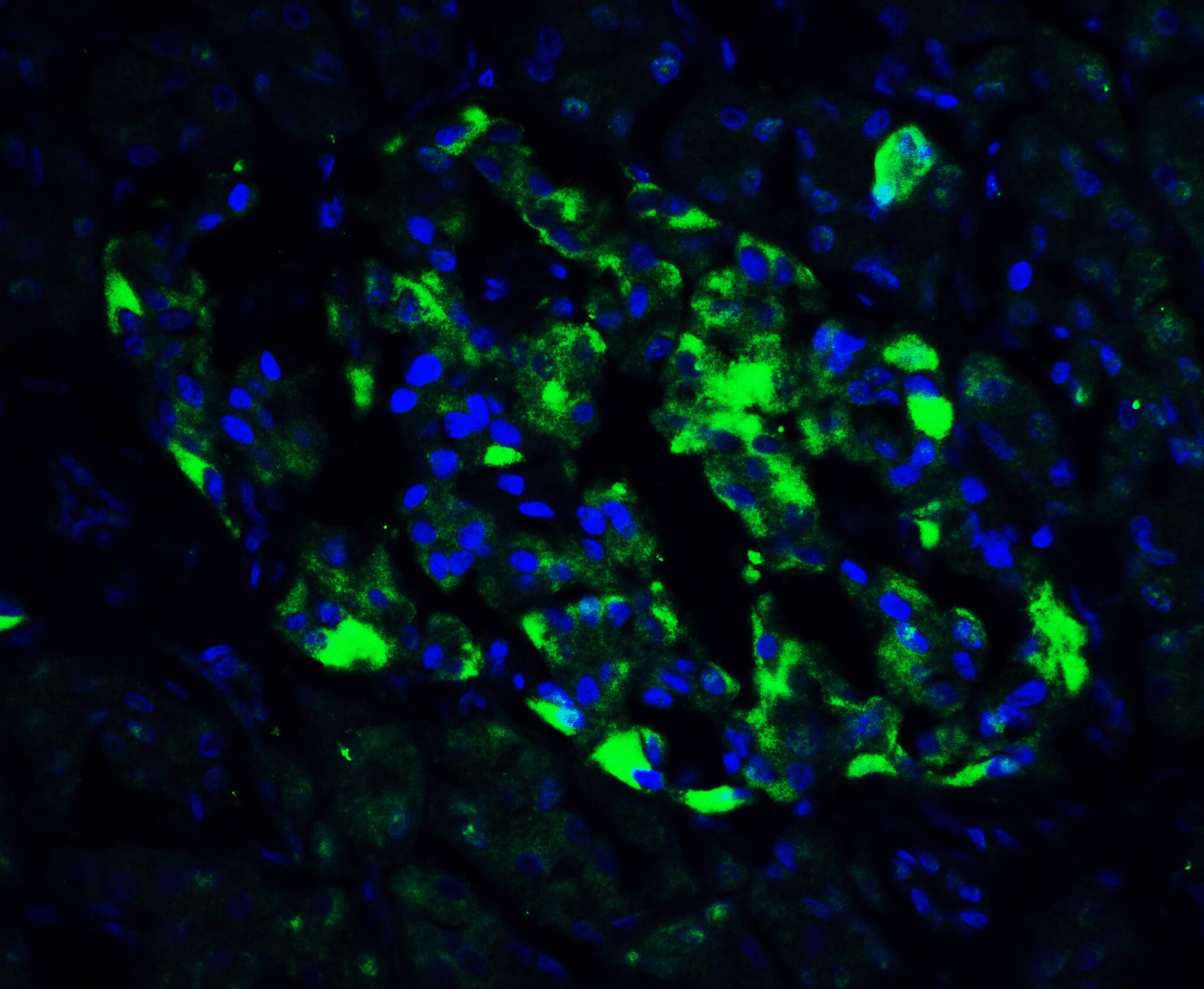 Immunocytochemistry/ Immunofluorescence: ATF6 Antibody - BSA Free [NBP1-76675] - Immunofluorescence of ATF6 in human pancreas tissue with ATF6 antibody at 20 u/ml.Green: ATF6 Antibody   Blue: DAPI staining