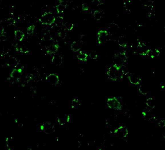 Immunocytochemistry/ Immunofluorescence: CARD10 Antibody - BSA Free [NBP1-76676] - Immunofluorescence of CARD10 in EL4 cells with CARD10 antibody at 20 u/mL.