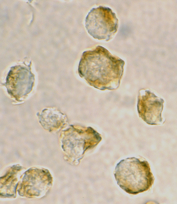 Immunocytochemistry/ Immunofluorescence: Nudel Antibody - BSA Free [NBP1-76677] - Immunocytochemistry of Nudel in Jurkat cells with Nudel antibody at 2 u/mL.