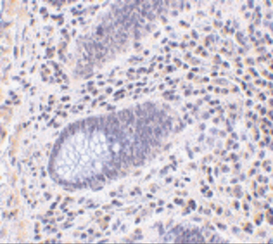 Immunohistochemistry: Lano Antibody - BSA Free [NBP1-76678] - Immunohistochemistry of Lano in human colon tissue with Lano antibody at 10 ug/mL.