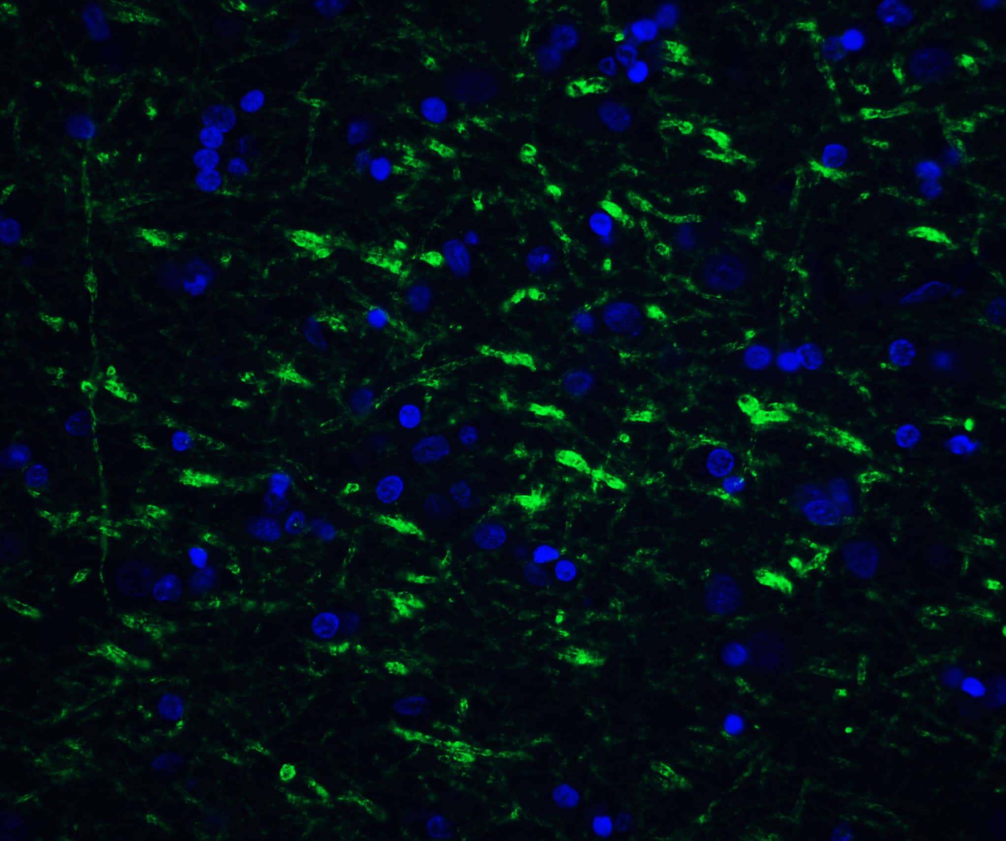 Immunocytochemistry/ Immunofluorescence: Tollip Antibody - BSA Free [NBP1-76681] - Immunofluorescence of Tollip in human brain tissue with Tollip antibody at 20 ug/ml.Green: Tollip Antibody   Blue: DAPI staining