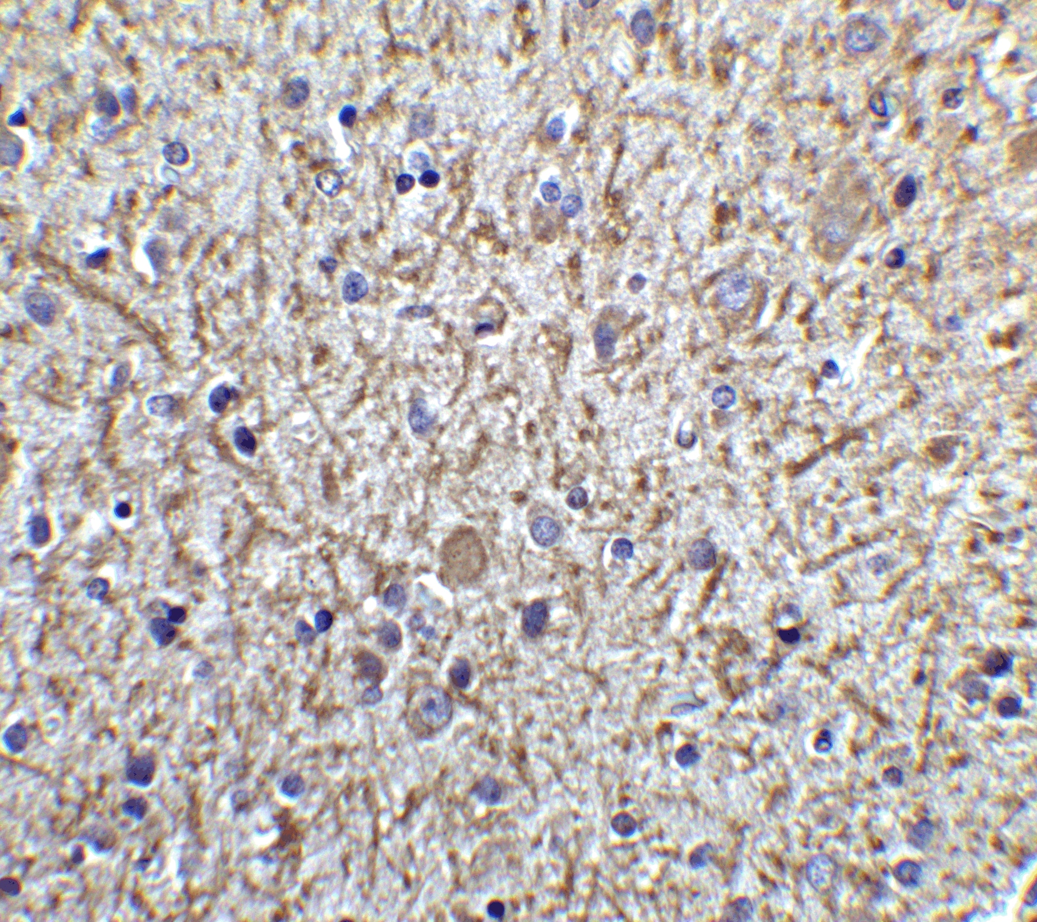 Immunohistochemistry: Tollip Antibody - BSA Free [NBP1-76681] - Immunohistochemistry of Tollip in human brain tissue with Tollip antibody at 5 ug/ml.