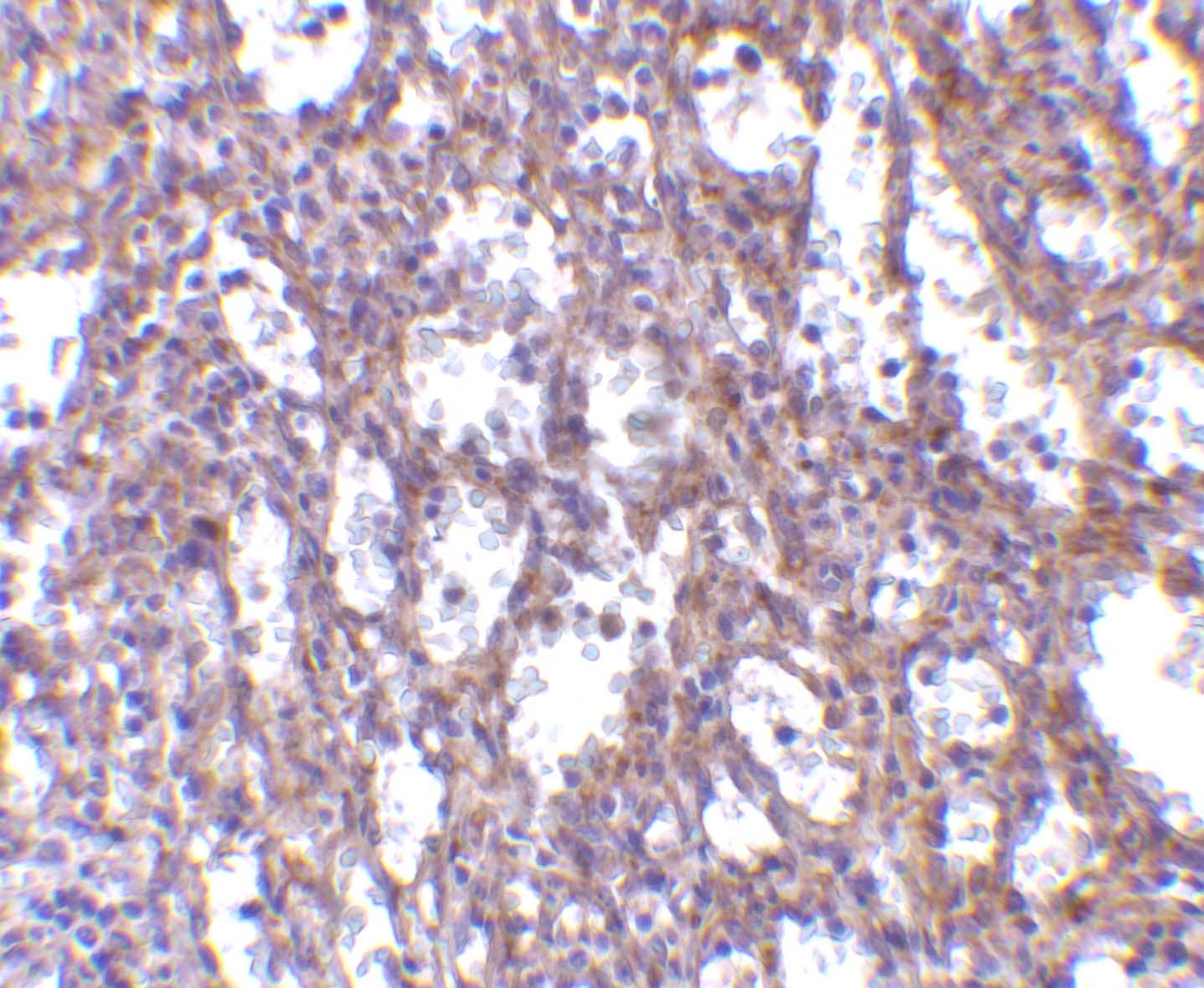 Immunohistochemistry: IL-32 Antibody - BSA Free [NBP1-76684] - Validation of IL-32 in Human Spleen Tissue.Immunohistochemical analysis of paraffin-embedded human spleen tissue using anti-IL-32 antibody  at 10 ug/ml. Tissue was fixed with formaldehyde and blocked with 10% serum for 1 h at RT; antigen retrieval was by heat mediation with a citrate buffer (pH6). Samples were incubated with primary antibody overnight at 4C. A goat anti-rabbit IgG H&L (HRP) at 1/250 was used as secondary. Counter stained with Hematoxylin.