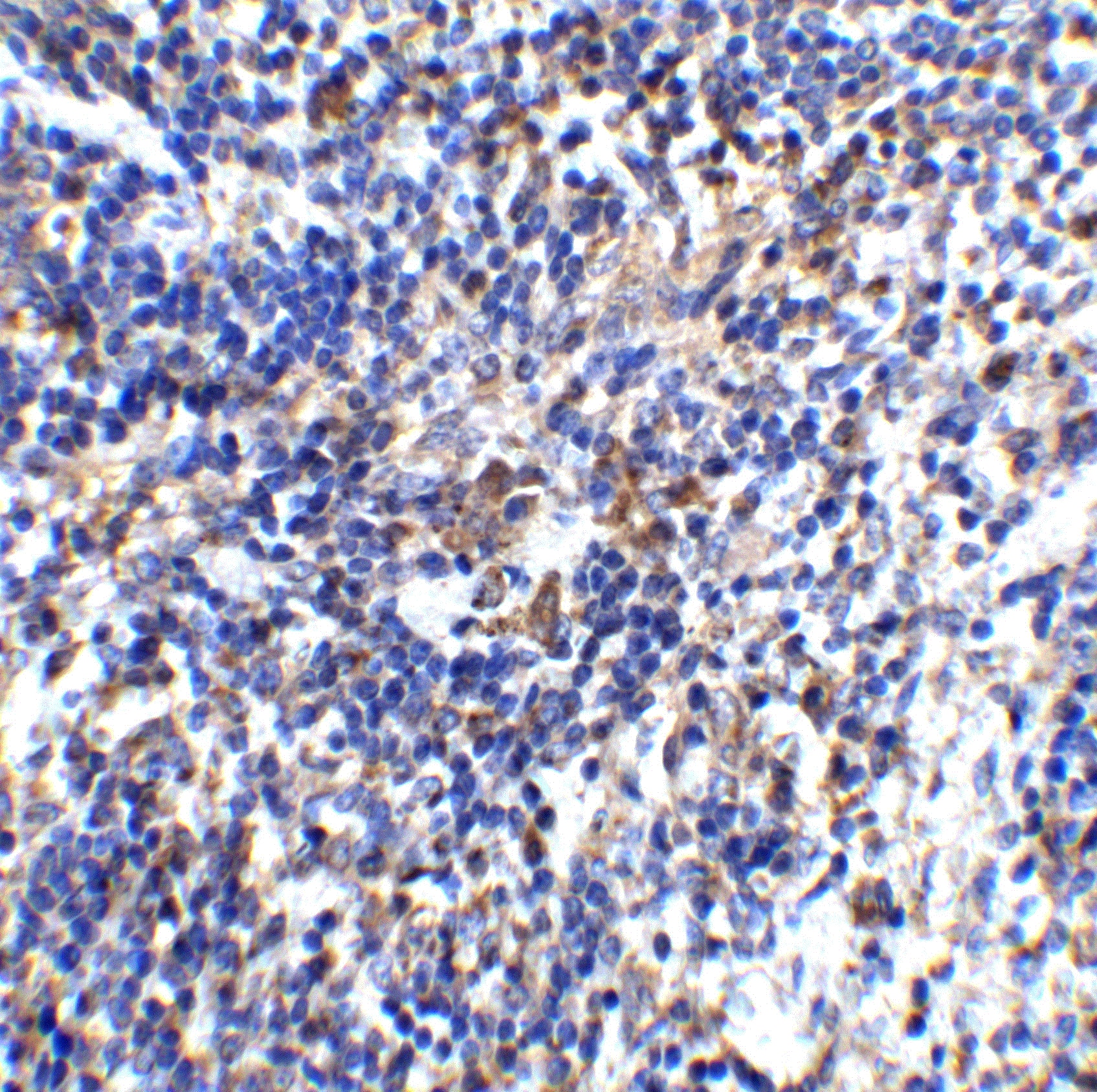 Immunohistochemistry: IL-32 Antibody - BSA Free [NBP1-76684] - Figure 5 Immunohistochemistry Validation of IL-32 in Mouse Spleen Tissue  Immunohistochemical analysis of paraffin-embedded mouse spleen tissue using anti-IL-32 antibody  at 2 u/ml. Tissue was fixed with formaldehyde and blocked with 10% serum for 1 h at RT; antigen retrieval was by heat mediation with a citrate buffer (pH6). Samples were incubated with primary antibody overnight at 4C. A goat anti-rabbit IgG H&L (HRP) at 1/250 was used as secondary. Counter stained with Hematoxylin.