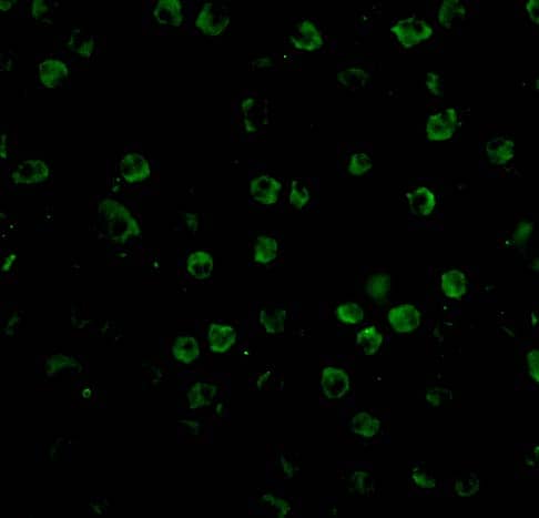 Immunocytochemistry/ Immunofluorescence: HVEM/TNFRSF14 Antibody - BSA Free [NBP1-76689] - Immunofluorescence of HVEM/TNFRSF14 in Raji cells with HVEM/TNFRSF14 antibody at 20 u/mL.