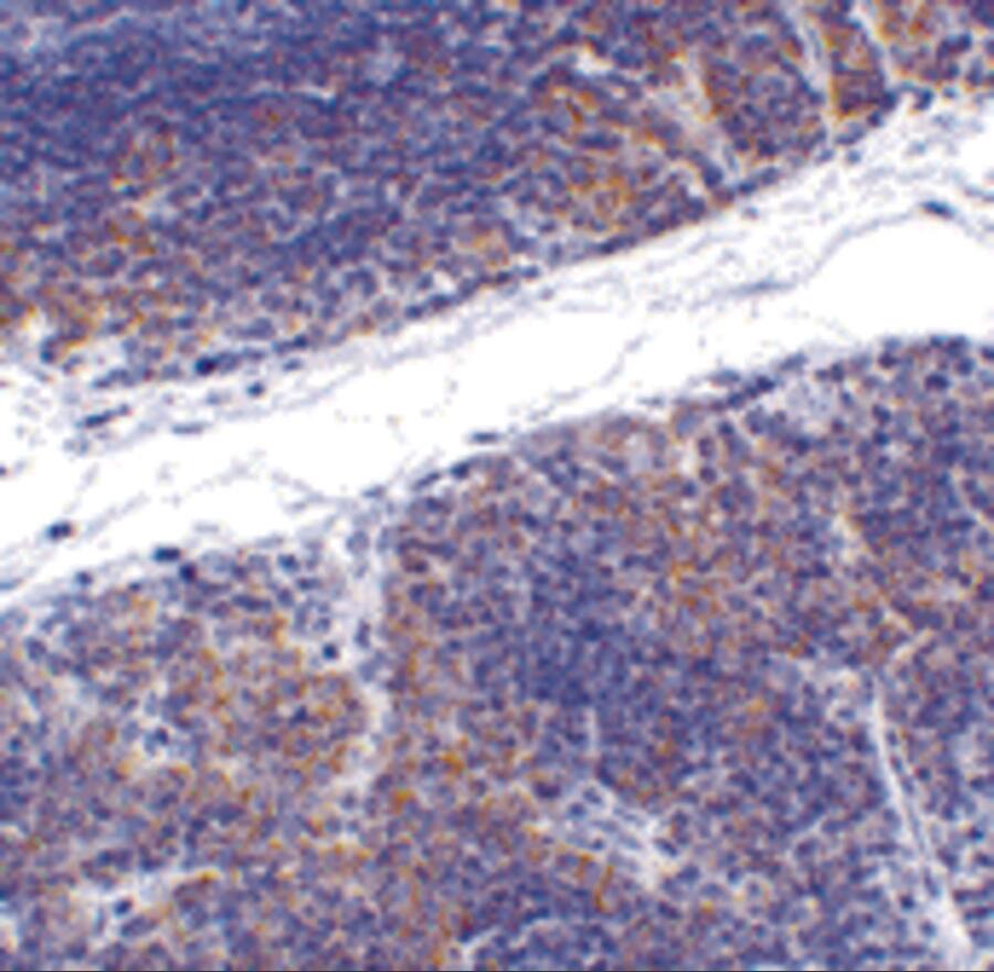 Immunohistochemistry: HVEM/TNFRSF14 Antibody - BSA Free [NBP1-76690] - Immunohistochemistry of HVEM/TNFRSF14 in mouse thymus tissue with HVEM/TNFRSF14 antibody at 1 ug/mL.