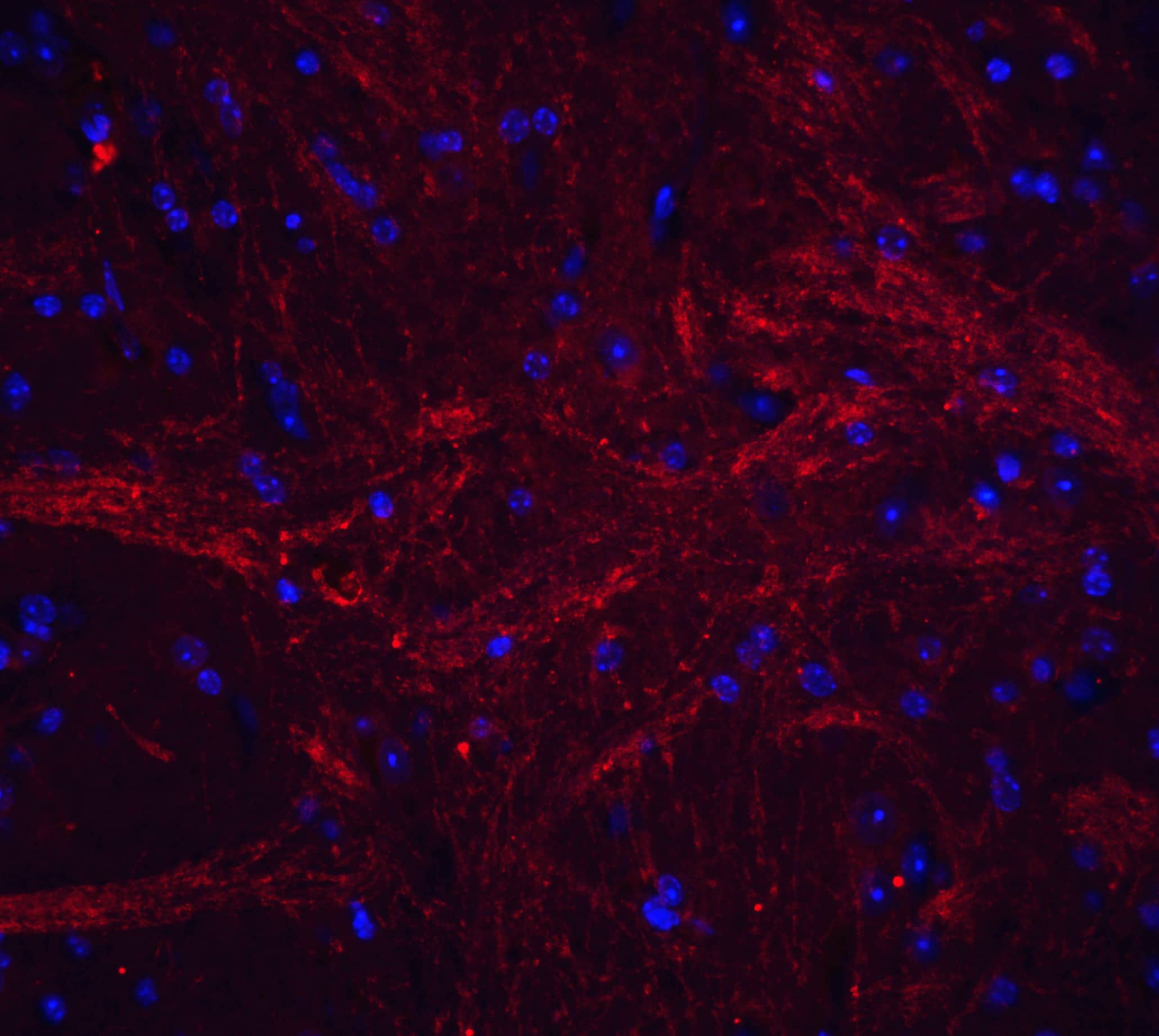 Immunocytochemistry/ Immunofluorescence: TWEAK/TNFSF12 Antibody - BSA Free [NBP1-76695] - Figure 6 Immunofluorescence Validation of TWEAK/TNFSF12 in Mouse Brain TissueImmunofluorescent analysis of 4% paraformaldehyde-fixed mouse brain tissue labeling TWEAK/TNFSF12 with  at 20 u/mL, followed by goat anti-rabbit IgG secondary antibody at 1/500 dilution (red) and DAPI staining (blue).  