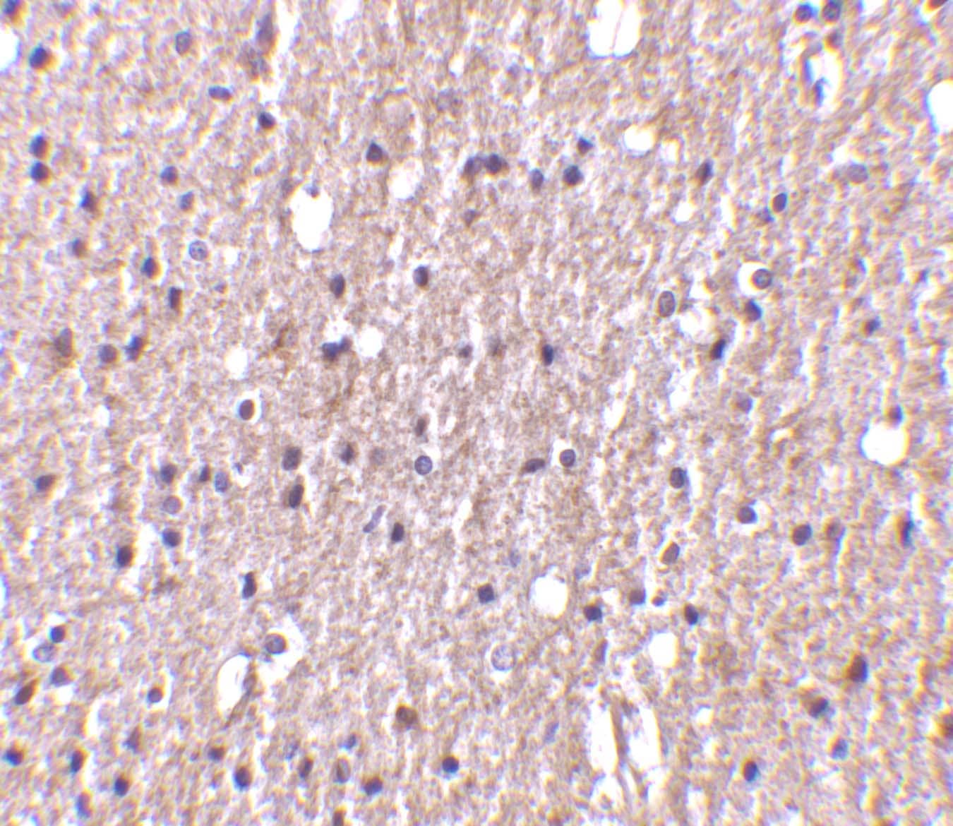 Immunohistochemistry: TWEAK/TNFSF12 Antibody - BSA Free [NBP1-76695] - Figure 5 Immunohistochemistry Validation of TWEAK/TNFSF12 in Human Brain Tissue  Immunohistochemical analysis of paraffin-embedded human brain tissue using anti-TWEAK/TNFSF12 antibody  at 10 u/ml. Tissue was fixed with formaldehyde and blocked with 10% serum for 1 h at RT; antigen retrieval was by heat mediation with a citrate buffer (pH6). Samples were incubated with primary antibody overnight at 4C. A goat anti-rabbit IgG H&L (HRP) at 1/250 was used as secondary. Counter stained with Hematoxylin.