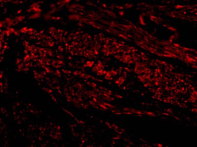 Immunocytochemistry/ Immunofluorescence: TIM-1/KIM-1/HAVCR Antibody - BSA Free [NBP1-76701] - Validation of TIM-1/KIM-1/HAVCR in Human Uterus Cells. Immunofluorescent analysis of 4% paraformaldehyde-fixed human uterus cells labeling TIM-1/KIM-1/HAVCR with  at 20 ug/mL, followed by goat anti-rabbit IgG secondary antibody at 1/500 dilution (red). Image showing both membrane and cytoplasmic staining on human uterus cells. 