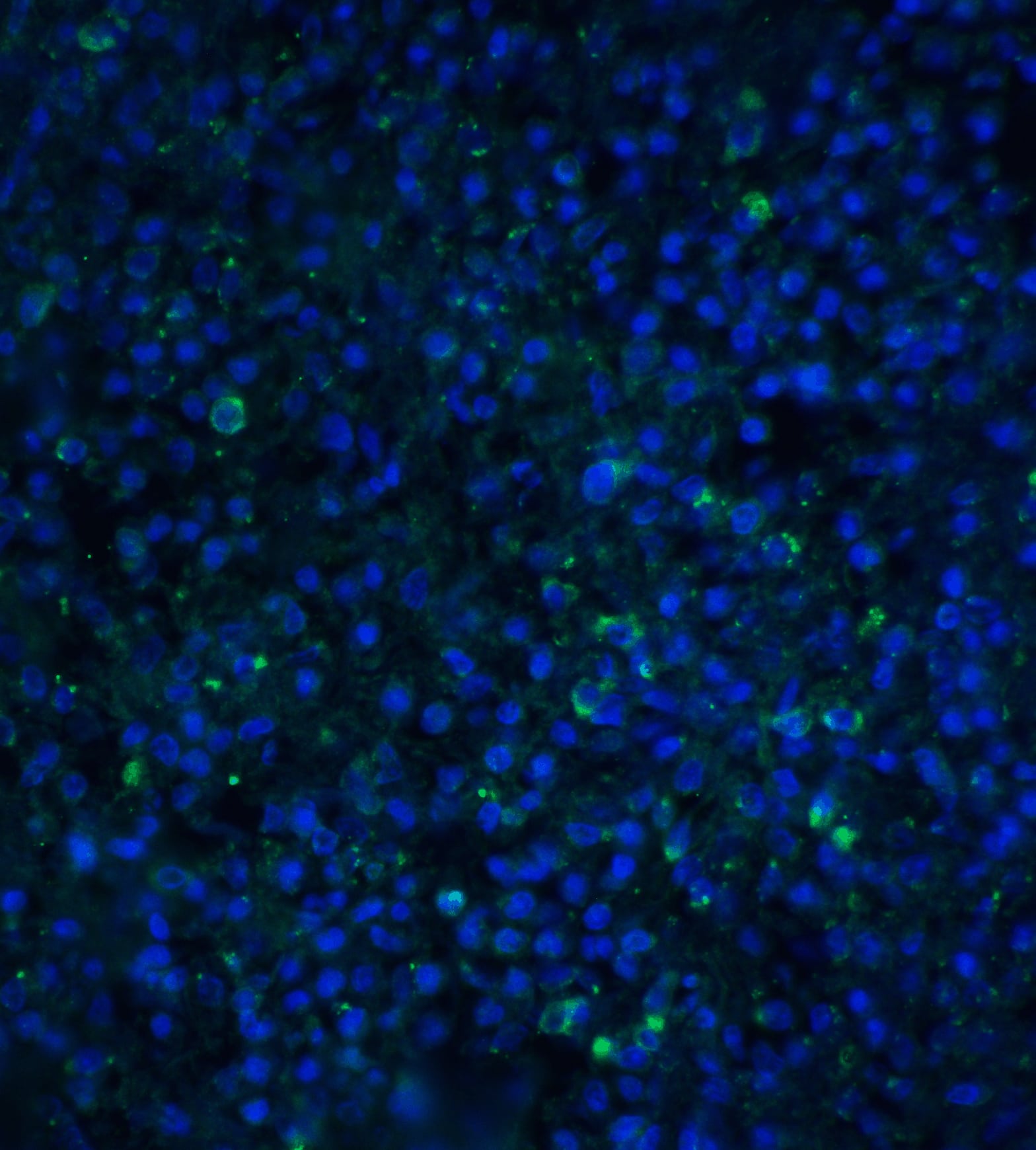 Immunocytochemistry/ Immunofluorescence: TIM-4 Antibody - BSA Free [NBP1-76702] - Immunofluorescence of TIM-4 in human spleen tissue with TIM-4 antibody at 20 u/ml.Green: TIM-4 Antibody   Blue: DAPI staining