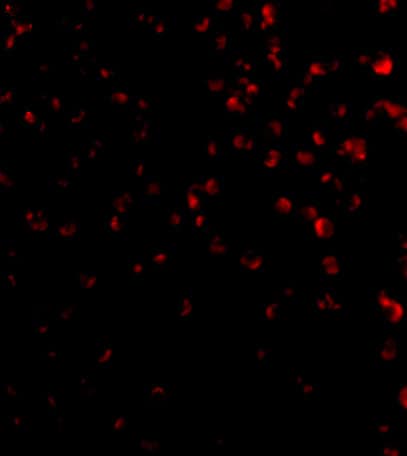 Immunocytochemistry/ Immunofluorescence: TIM-4 Antibody - BSA Free [NBP1-76702] - Immunofluorescence of TIM-4 in Jurkat cells with TIM-4 antibody at 20 u/mL.