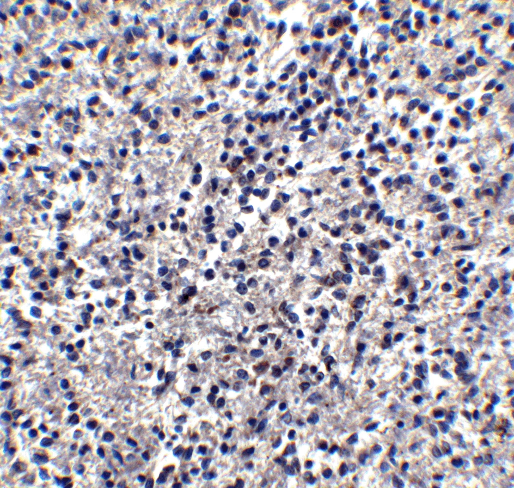 Immunohistochemistry: TIM-4 Antibody - BSA Free [NBP1-76702] - Immunohistochemistry of TIM-4 in human spleen tissue with TIM-4 antibody at 2.5 u/ml.