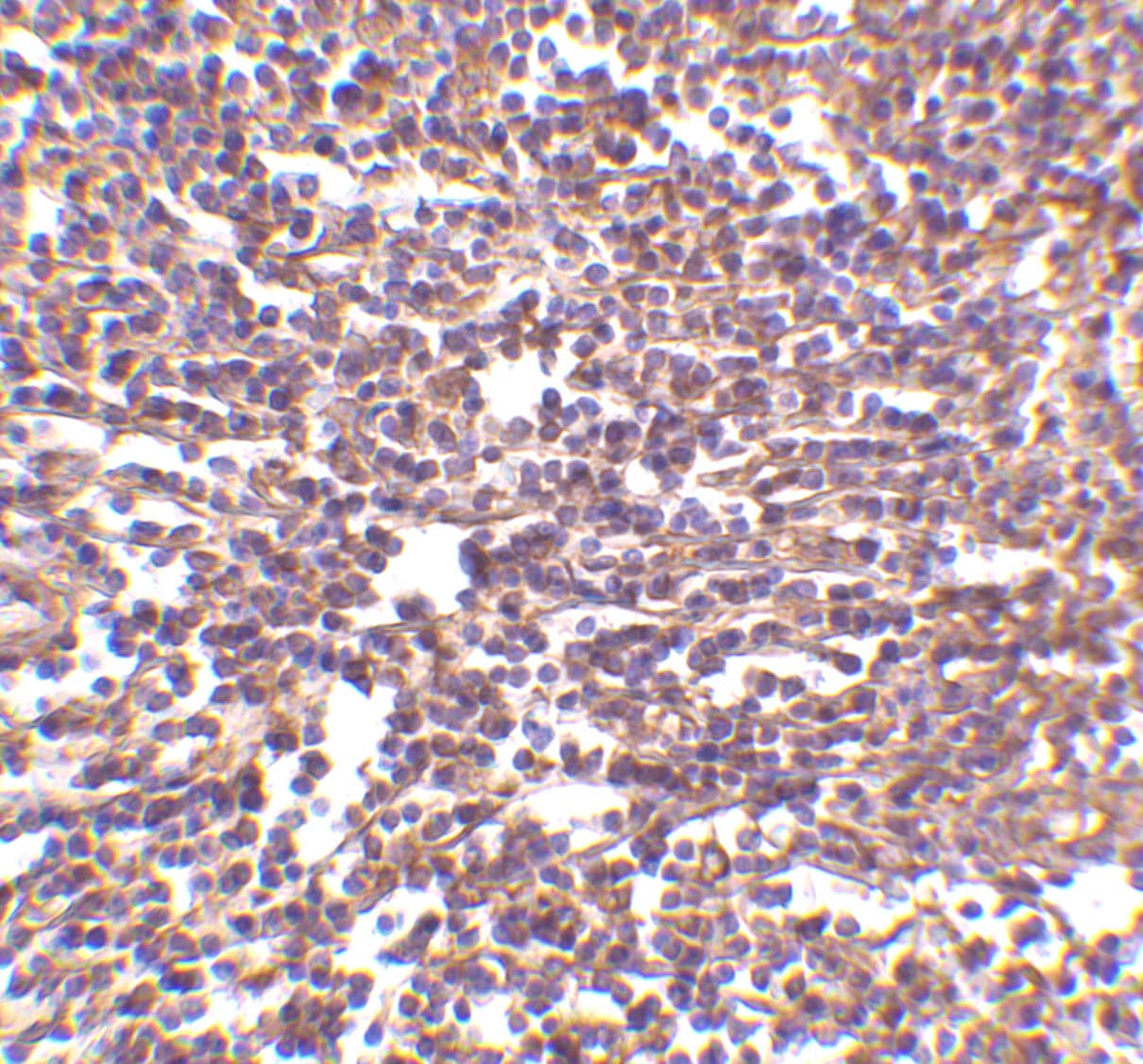Immunohistochemistry: RP105/CD180 Antibody - BSA Free [NBP1-76707] - Immunohistochemistry of RP105/CD180 in human spleen tissue with RP105/CD180 antibody at 2 ug/mL.