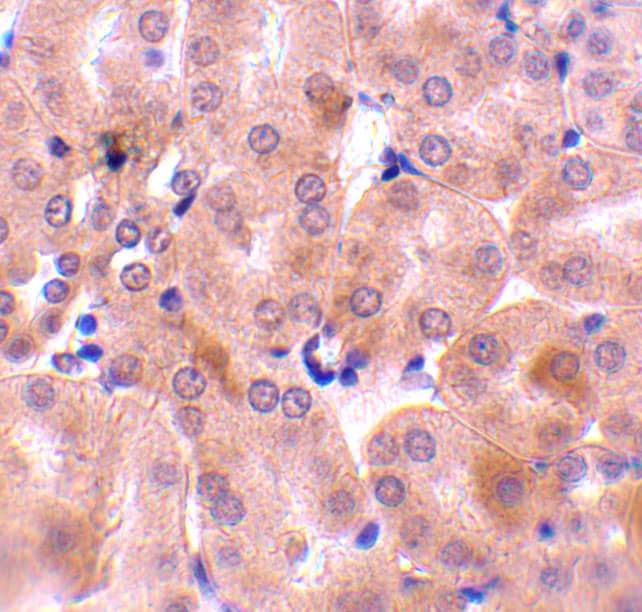 Immunohistochemistry Bcl-2 related protein A1 Antibody - BSA Free