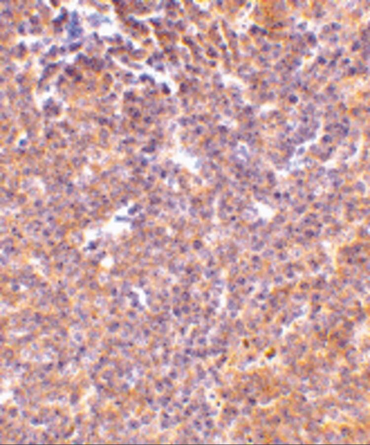 Immunohistochemistry: PAK2 Antibody - BSA Free [NBP1-76720] - Figure 5 Immunohistochemistry Validation of PAK2 in Mouse Spleen Tissue  Immunohistochemical analysis of paraffin-embedded mouse kidney tissue using anti-PAK2 antibody  at 10 u/ml. Tissue was fixed with formaldehyde and blocked with 10% serum for 1 h at RT; antigen retrieval was by heat mediation with a citrate buffer (pH6). Samples were incubated with primary antibody overnight at 4;C. A goat anti-rabbit IgG H&L (HRP) at 1/250 was used as secondary. Counter stained with Hematoxylin.