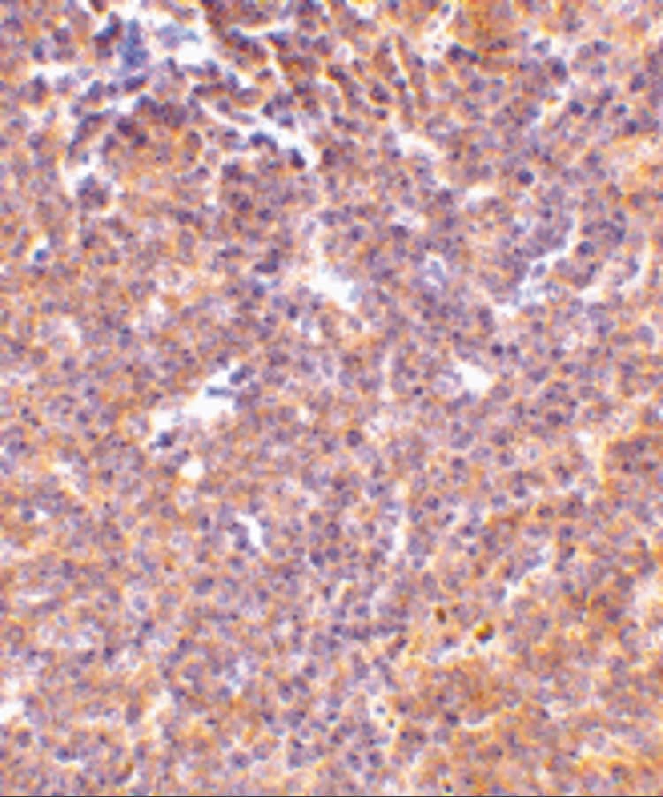 Immunohistochemistry: PAK2 Antibody - BSA Free [NBP1-76720] - Figure 5 Immunohistochemistry Validation of PAK2 in Mouse Spleen Tissue  Immunohistochemical analysis of paraffin-embedded mouse kidney tissue using anti-PAK2 antibody  at 10 u/ml. Tissue was fixed with formaldehyde and blocked with 10% serum for 1 h at RT; antigen retrieval was by heat mediation with a citrate buffer (pH6). Samples were incubated with primary antibody overnight at 4C. A goat anti-rabbit IgG H&L (HRP) at 1/250 was used as secondary. Counter stained with Hematoxylin.