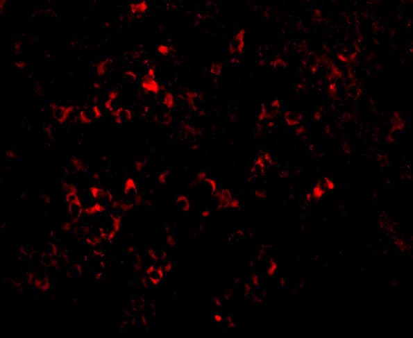 Immunocytochemistry/ Immunofluorescence: PAK2 Antibody - BSA Free [NBP1-76721] - Validation of PAK2 in Mouse Spleen TissueImmunofluorescent analysis of 4% paraformaldehyde-fixed mouse spleen tissue labeling PAK2 with  at 20 ug/mL, followed by goat anti-rabbit IgG secondary antibody at 1/500 dilution (red).  