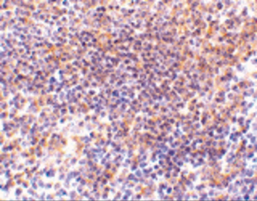 Immunohistochemistry: PAK2 Antibody - BSA Free [NBP1-76721] - Validation of PAK2 in Mouse Spleen Tissue.   Immunohistochemical analysis of paraffin-embedded mouse kidney tissue using anti-PAK2 antibody  at 10 ug/ml. Tissue was fixed with formaldehyde and blocked with 10% serum for 1 h at RT; antigen retrieval was by heat mediation with a citrate buffer (pH6). Samples were incubated with primary antibody overnight at 4C. A goat anti-rabbit IgG H&L (HRP) at 1/250 was used as secondary. Counter stained with Hematoxylin.