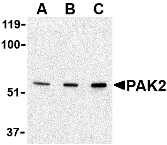 Western Blot: PAK2 Antibody - BSA Free [NBP1-76721] - Validation in Jurkat LysateLoading: 15 ug of lysates per lane.Antibodies: PAK2  (A: 0.5 ug/mL, B: 1 ug/mL and C: 2 ug/mL), 1h incubation at RT in 5% NFDM/TBST.Secondary: Goat anti-rabbit IgG HRP conjugate at 1:10000 dilution.