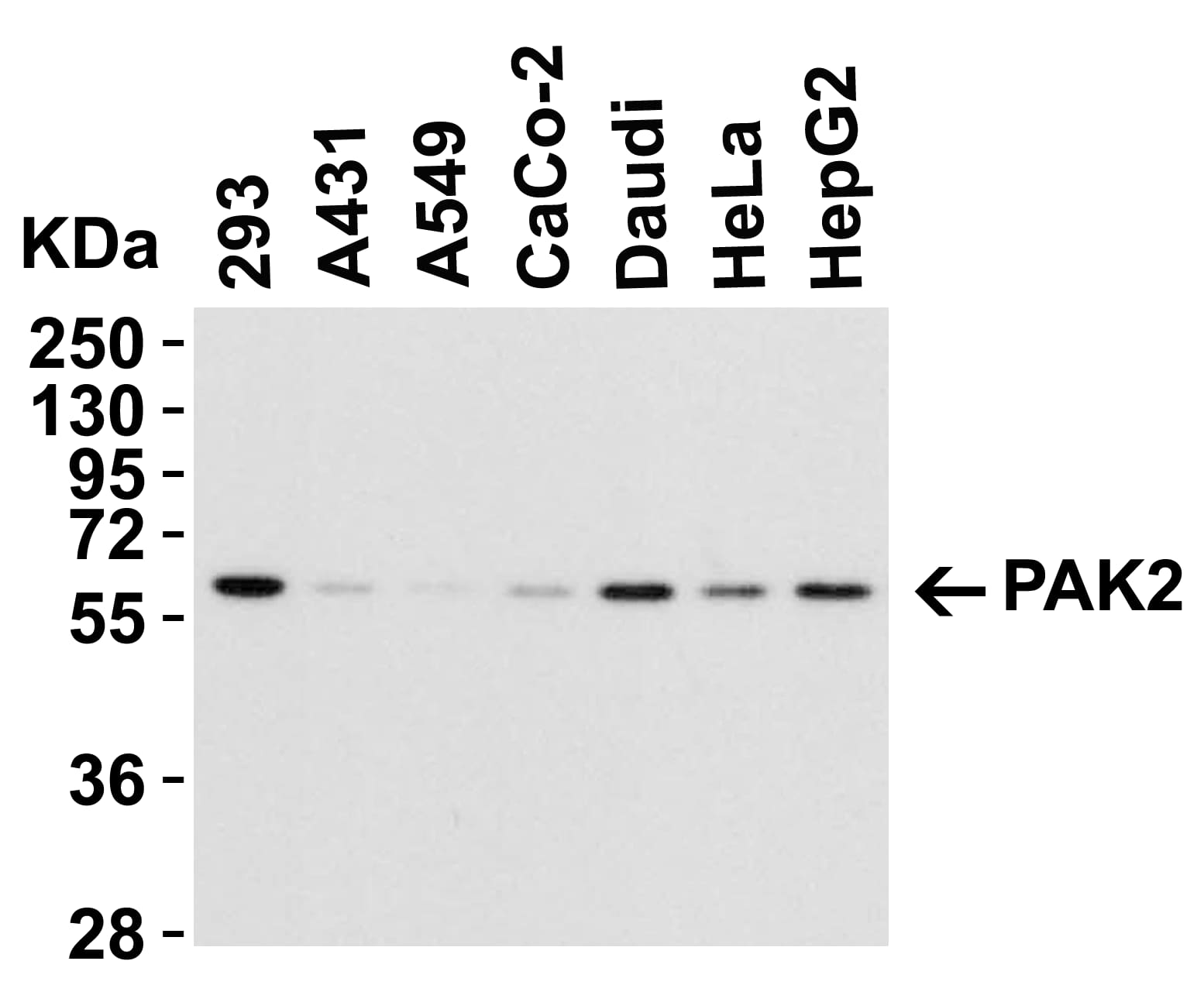 Western Blot: PAK2 Antibody - BSA Free [NBP1-76721] - Validation in Human Cell Lines. Loading: 15 ug of lysates per lane.Antibodies: PAK2   (1 ug/mL), 1h incubation at RT in 5% NFDM/TBST.Secondary: Goat anti-rabbit IgG HRP conjugate at 1:10000 dilution.