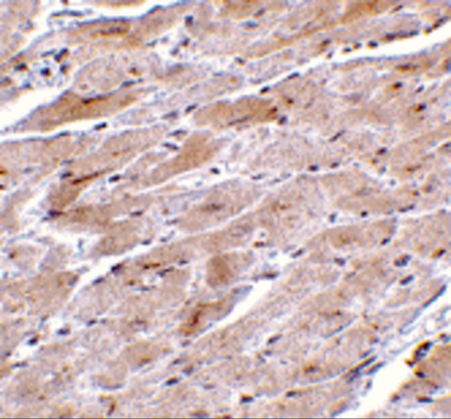Immunohistochemistry: TRPC3 Antibody - BSA Free [NBP1-76722] - Immunohistochemistry of TRPC3 in mouse heart tissue with TRPC3 antibody at 10 ug/mL.