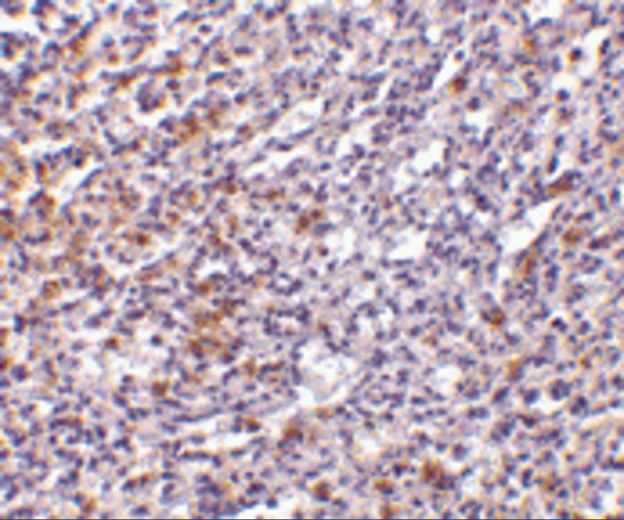 Immunohistochemistry: IL-27R alpha/WSX-1/TCCR Antibody - BSA Free [NBP1-76728] - Immunohistochemistry of IL-27R alpha/WSX-1/TCCR in human spleen tissue with IL-27R alpha/WSX-1/TCCR antibody at 10 ug/mL.