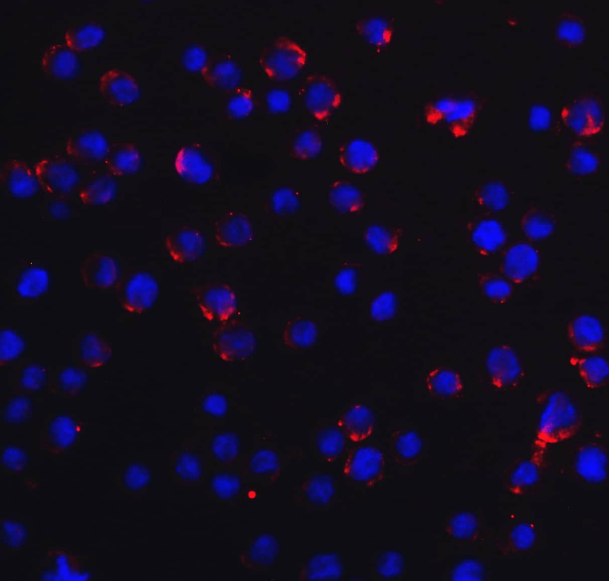 Immunocytochemistry/ Immunofluorescence: RIG-I Antibody - BSA Free [NBP1-76732] - Immunofluorescence of RIG-I in MCF7 cells with RIG-I Antibody at 20 ug/mL.