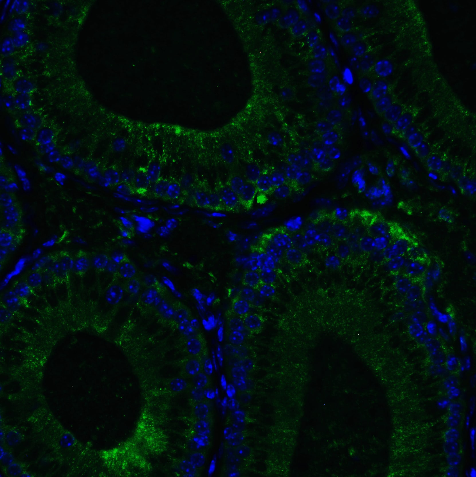 Immunocytochemistry/ Immunofluorescence: RIG-I Antibody - BSA Free [NBP1-76732] - Immunofluorescence of RIG-I in mouse testis tissue with RIG-I Antibody at 20 ug/mL.