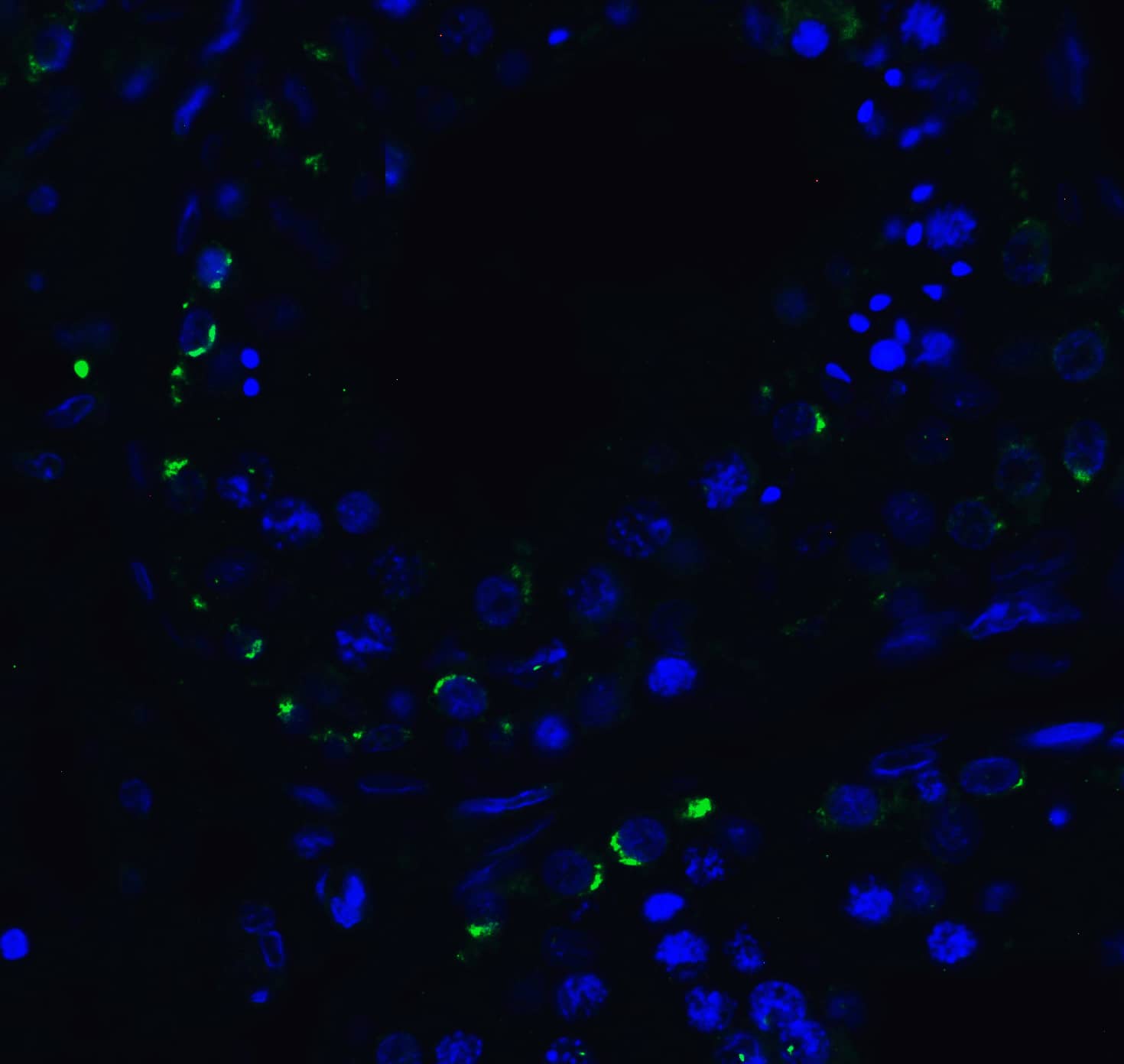 Immunocytochemistry/ Immunofluorescence: RIG-I Antibody - BSA Free [NBP1-76732] - Immunofluorescence of RIG-I in human testis tissue with RIG-I Antibody at 20 ug/mL.