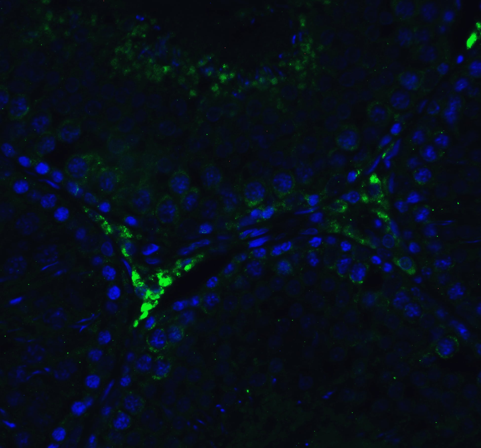 Immunocytochemistry/ Immunofluorescence: RIG-I Antibody - BSA Free [NBP1-76732] - Immunofluorescence of RIG-I in rat testis tissue with RIG-I Antibody at 20 ug/mL.