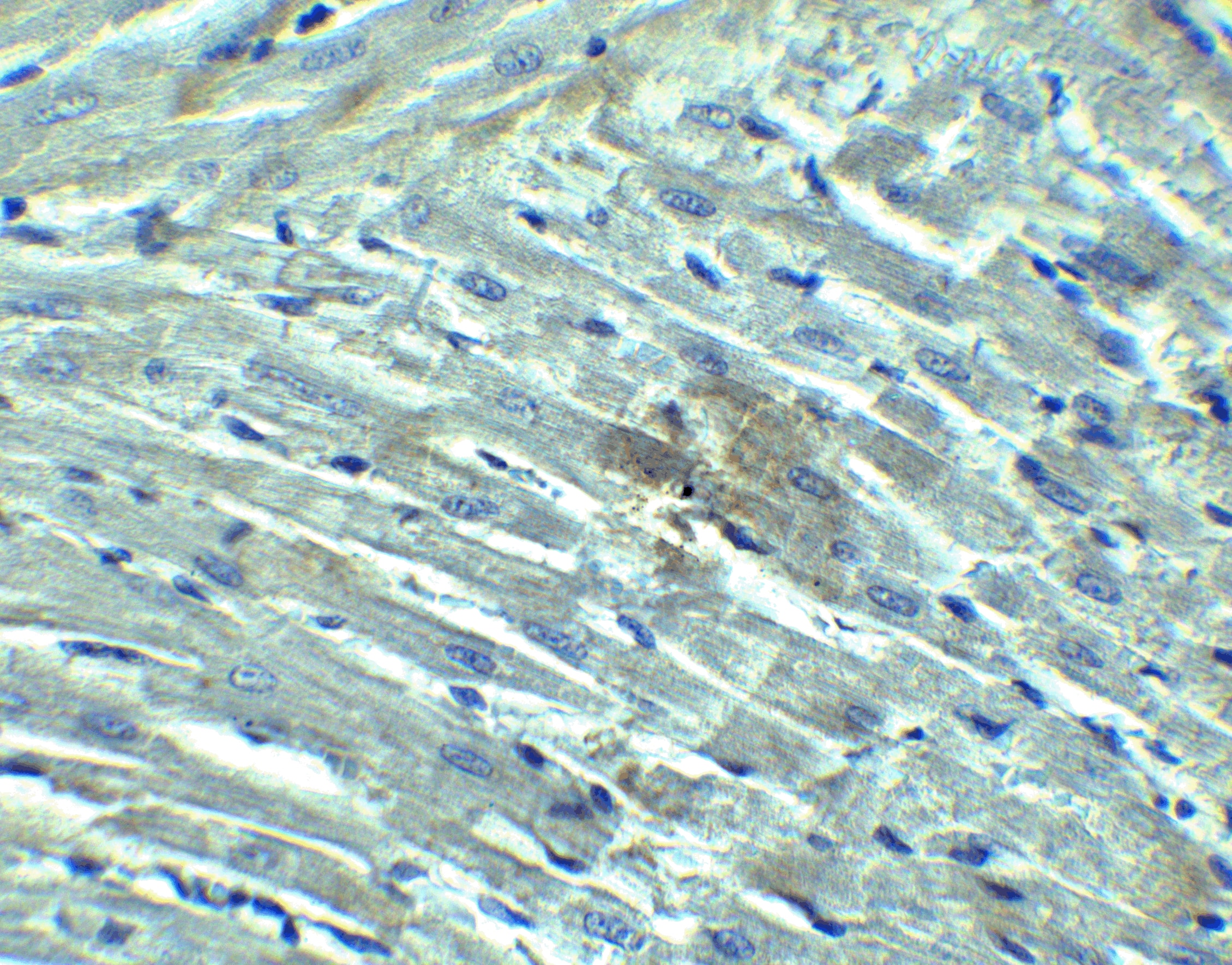 Immunohistochemistry: RIG-I Antibody - BSA Free [NBP1-76732] - Immunohistochemistry of RIG-I in rat heart tissue with RIG-I Antibody at 10 ug/mL.