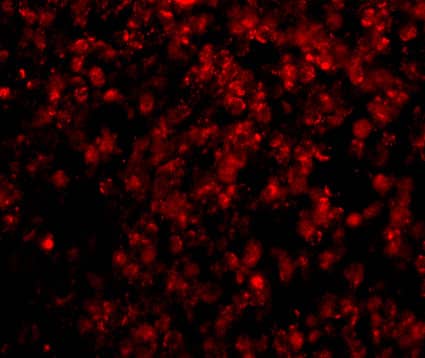 Immunocytochemistry/ Immunofluorescence: Hormone-sensitive Lipase/HSL Antibody - BSA Free [NBP1-76735] - Immunofluorescence of Hormone-sensitive Lipase/HSL in Human Lymph Node cells with Hormone-sensitive Lipase/HSL antibody at 20 u/mL.