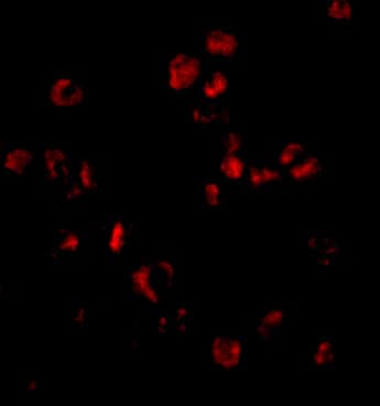 Immunocytochemistry/ Immunofluorescence: SUMO1 Antibody - BSA Free [NBP1-76737] - Immunofluorescence of SUMO1 in HL60 cells with SUMO1 antibody at 20 u/mL.