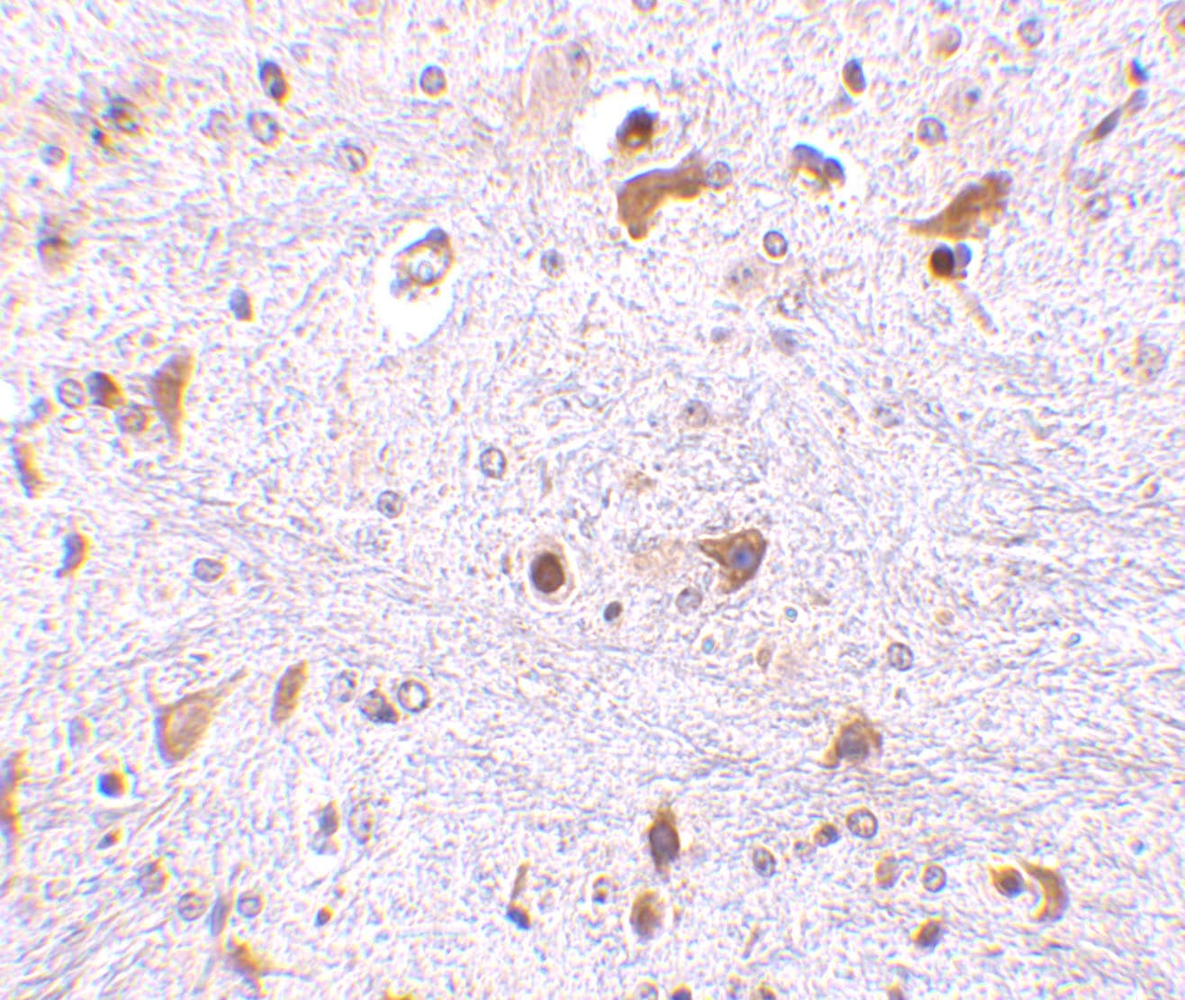 Immunohistochemistry: PDCD4 Antibody - BSA Free [NBP1-76738] - Immunohistochemistry of PDCD4 in mouse brain tissue with PDCD antibody at 2.5 ug/mL.