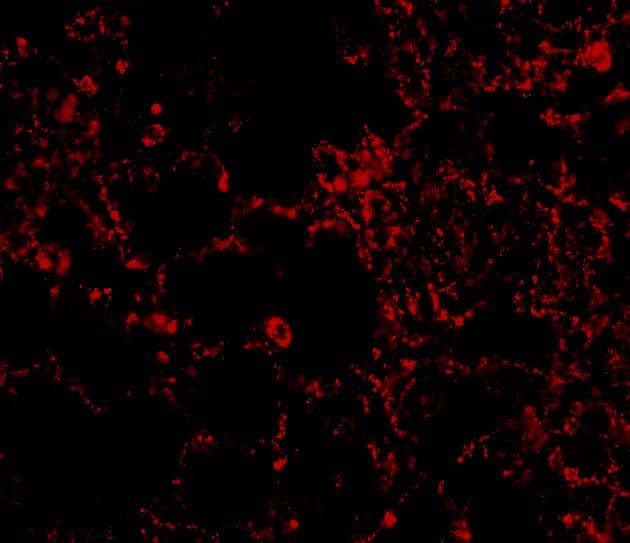 Immunocytochemistry/ Immunofluorescence: IL-21R Antibody - BSA Free [NBP1-76739] - Immunofluorescence of IL-21 Receptor in Rat Lung cells with IL-21 Receptor antibody at 20 u/mL.