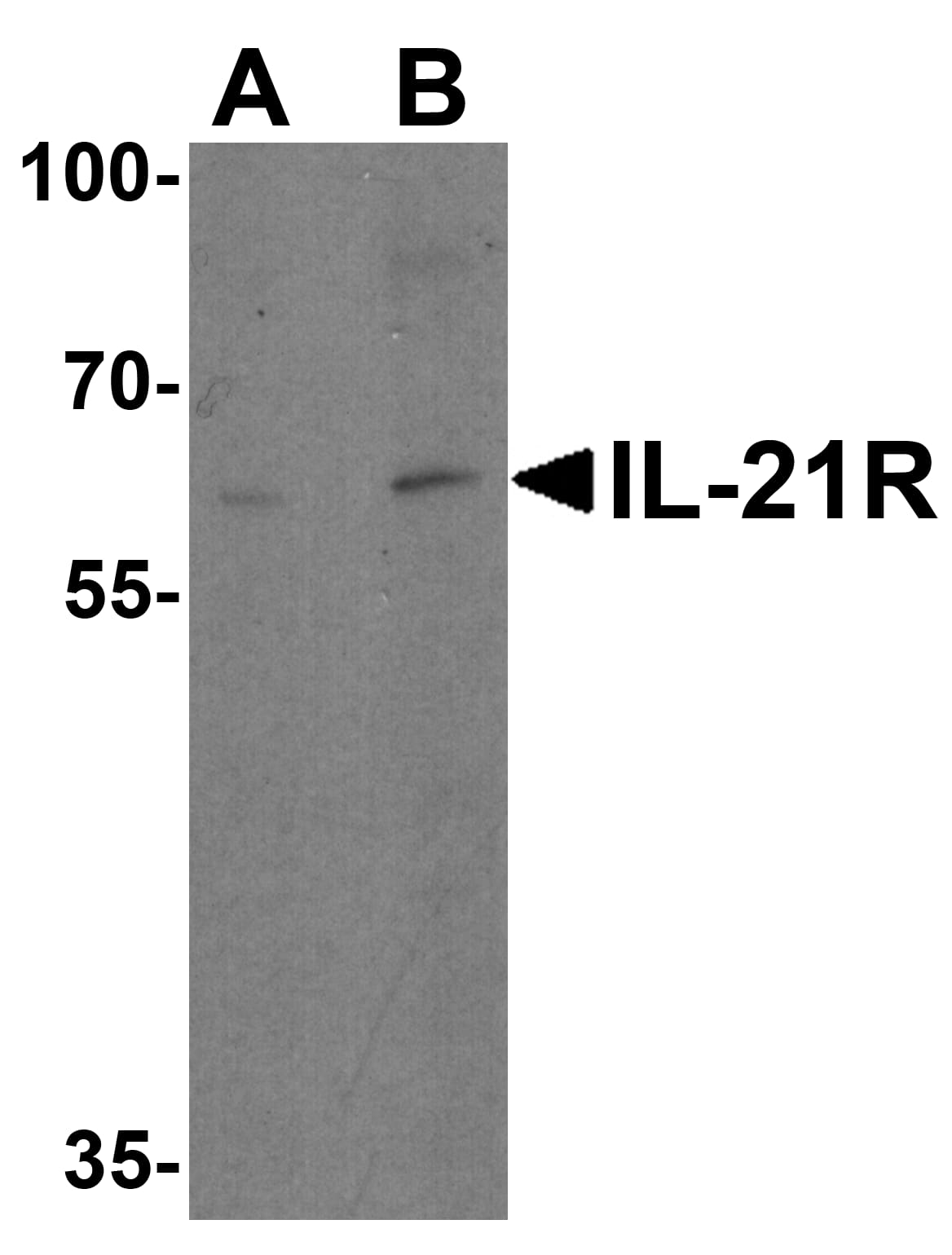 Western Blot: IL-21R Antibody - BSA Free [NBP1-76739] - Western blot analysis of IL-21R in human HepG2 cell lysate with IL-21 receptor antibody at (A) 1 and (B) 2 u/ml.