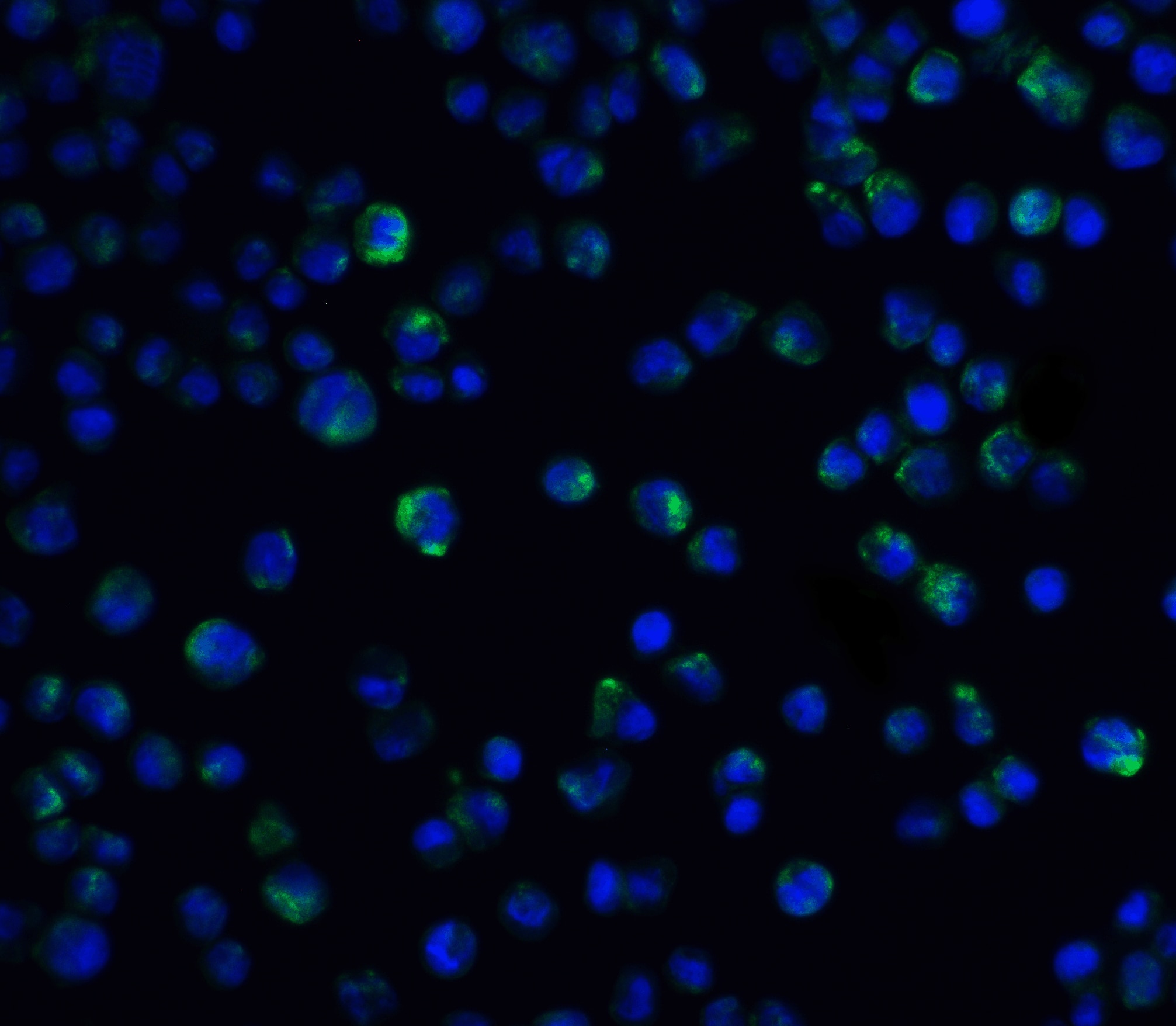 Immunohistochemistry: IL-21R Antibody - BSA Free [NBP1-76739] - Treatment of avian xenografts with IL-21 upregulates Blimp-1 expression. (A) The three-dimensional growth of BxPC-3 cells transplanted on the CAM of fertilized chicken eggs & resected tumors (three replicates) from vehicle control & IL-21 were photographed at day 17 of embryonic development. Upper row for vehicle control; lower row for IL-21-treated (150 ng/mL) tumors. (B) HE & IL-21R (brown) IHC staining of vehicle control & IL-21-treated (150 ng/mL) resected xenograft tumors. (C) Comparison & quantification of Blimp-1 (nuclei: red) expression of vehicle control & IL-21-treated (150 ng/mL) xenograft tumors. **** P Green: IL-21 Receptor Antibody   Blue: DAPI staining