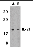 Western Blot: IL-21 Antibody - BSA Free [NBP1-76740] - Figure 3 Western Blot Validation in Human HL-60 Cell LysateLoading: 15 u of lysates per lane.Antibodies: IL-21  (1 u/mL), 1h incubation at RT in 5% NFDM/TBST.Secondary: Goat anti-rabbit IgG HRP conjugate at 1:10000 dilution.(A) Absence of blocking peptide(B) Presence of blocking peptide.