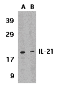 Western Blot: IL-21 Antibody - BSA Free [NBP1-76740] - Validation in Human HL-60 Cell Lysate. Loading: 15 ug of lysates per lane.Antibodies: IL-21  (1 ug/mL), 1h incubation at RT in 5% NFDM/TBST.Secondary: Goat anti-rabbit IgG HRP conjugate at 1:10000 dilution.(A) Absence of blocking peptide(B) Presence of blocking peptide.