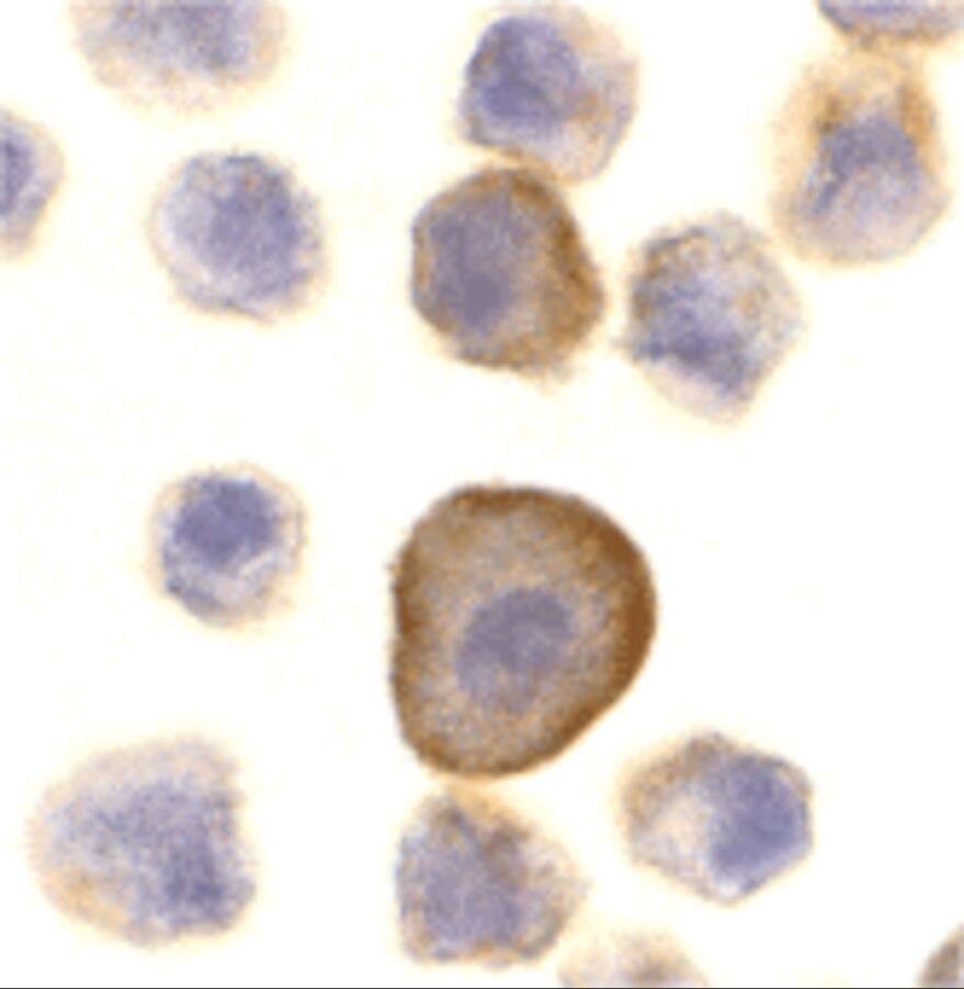 Immunocytochemistry/ Immunofluorescence: PERP Antibody - BSA Free [NBP1-76741] - Figure 4 Immunocytochemistry Validation of PERP in A431 CellsImmunocytochemical analysis of A431 cells using anti-PEPR antibody  at 10 u/ml. Cells was fixed with formaldehyde and blocked with 10% serum for 1 h at RT; antigen retrieval was by heat mediation with a citrate buffer (pH6). Samples were incubated with primary antibody overnight at 4;C. A goat anti-rabbit IgG H&L (HRP) at 1/250 was used as secondary. Counter stained with Hematoxylin.