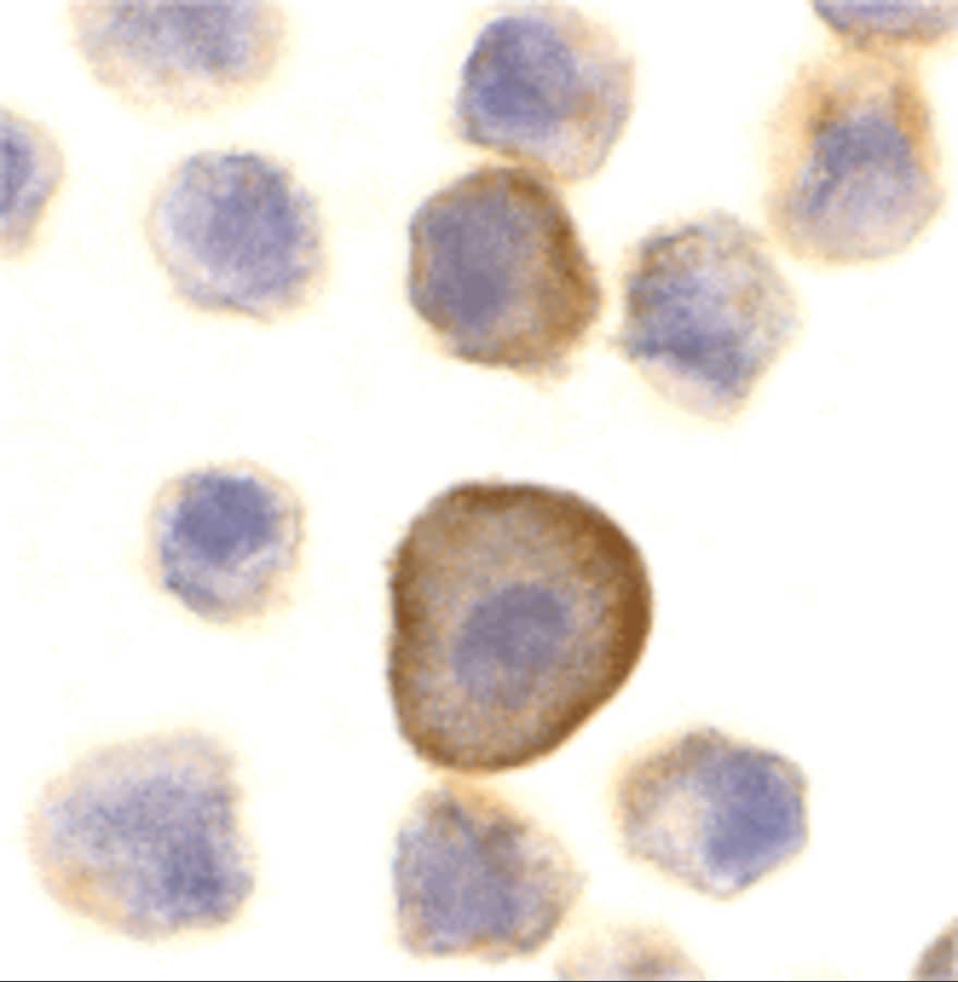 Immunocytochemistry/ Immunofluorescence: PERP Antibody - BSA Free [NBP1-76741] - Figure 4 Immunocytochemistry Validation of PERP in A431 CellsImmunocytochemical analysis of A431 cells using anti-PEPR antibody  at 10 u/ml. Cells was fixed with formaldehyde and blocked with 10% serum for 1 h at RT; antigen retrieval was by heat mediation with a citrate buffer (pH6). Samples were incubated with primary antibody overnight at 4C. A goat anti-rabbit IgG H&L (HRP) at 1/250 was used as secondary. Counter stained with Hematoxylin.