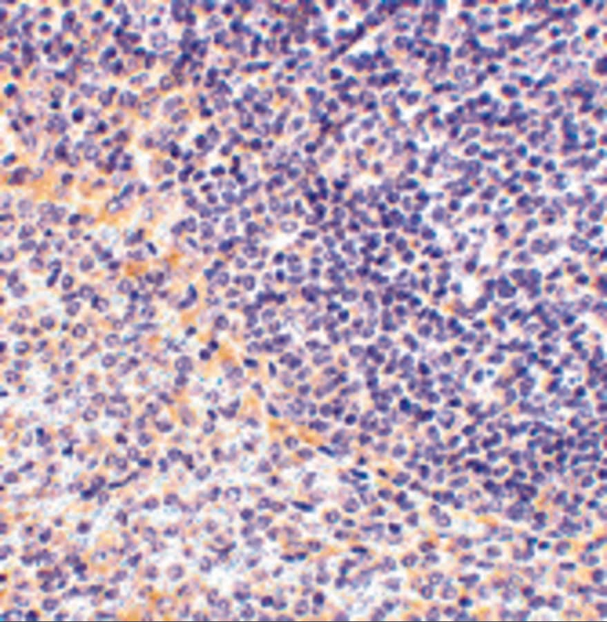 Immunohistochemistry: FAF1 Antibody - BSA Free [NBP1-76745] - Immunohistochemistry of FAF1 in rat spleen tissue with FAF1 antibody at 2.5 u/mL.
