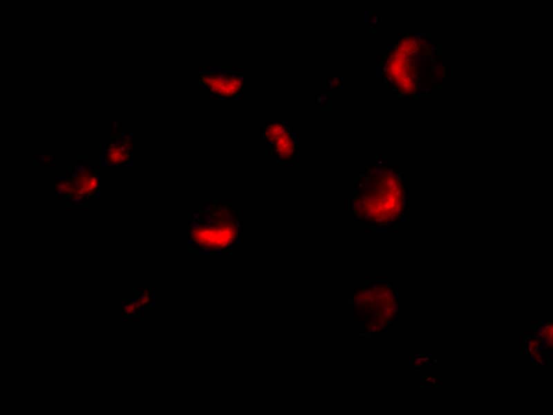 Immunocytochemistry/ Immunofluorescence: MTA2 Antibody - BSA Free [NBP1-76748] - Immunofluorescence of MTA2 in HeLa cells with MTA2 antibody at 10 ug/mL.