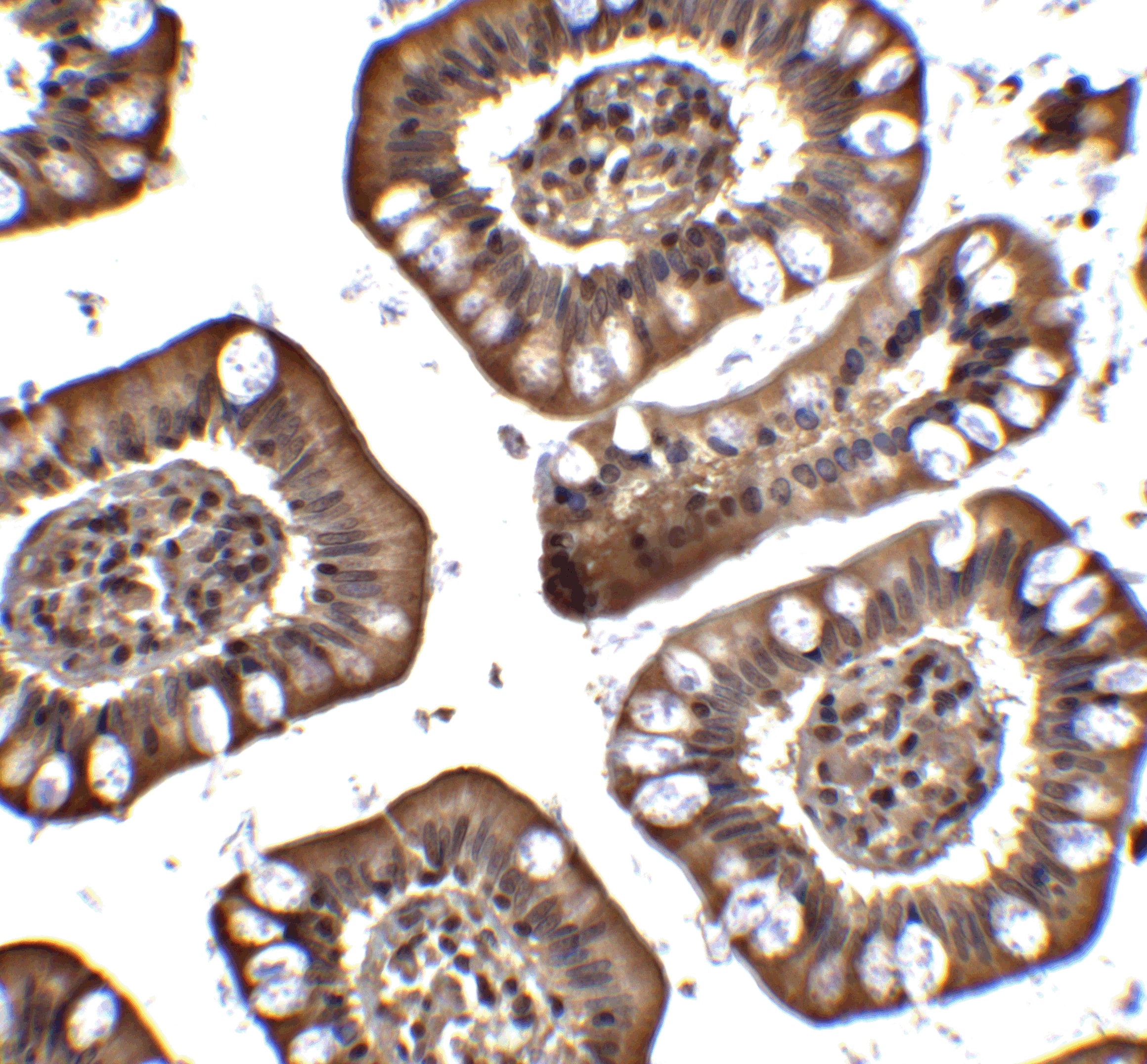 Immunohistochemistry: MTA2 Antibody - BSA Free [NBP1-76748] - Immunohistochemistry of MTA2 in human small intestine tissue with MTA2 antibody at 2.5 ug/ml.