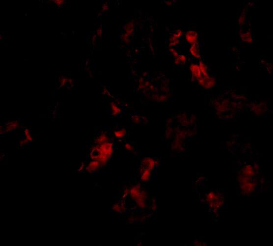 Immunocytochemistry/ Immunofluorescence: BANF1 Antibody - BSA Free [NBP1-76750] - Figure 2 Western Blot Validation in Human Kidney Tissue LysateLoading: 15 u of lysates per lane.Antibodies: BANF1  (A: 0.5 u/mL and B: 1 u/mL), 1h incubation at RT in 5% NFDM/TBST.Secondary: Goat anti-rabbit IgG HRP conjugate at 1:10000 dilution.