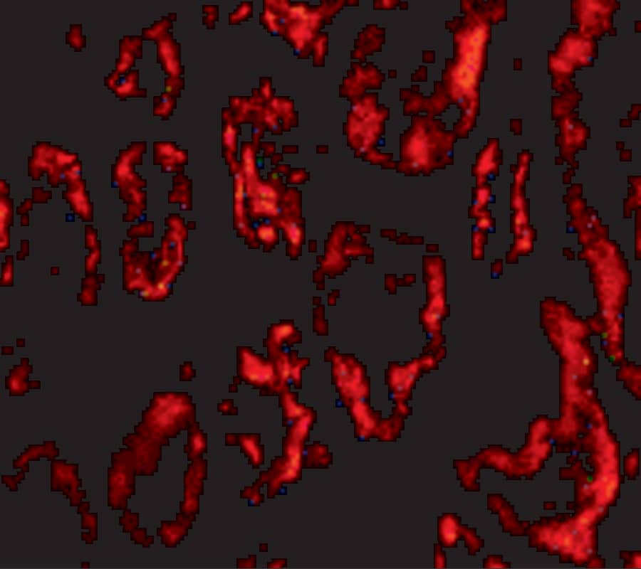 Immunocytochemistry/ Immunofluorescence: BANF1 Antibody - BSA Free [NBP1-76751] - Figure 5  Immunofluorescence Validation of BANF1 in Human Kideny TissueImmunofluorescent analysis of 4% paraformaldehyde-fixed human kidney tissue labeling BANF1 with  at 20 u/mL, followed by goat anti-rabbit IgG secondary antibody at 1/500 dilution (red).  