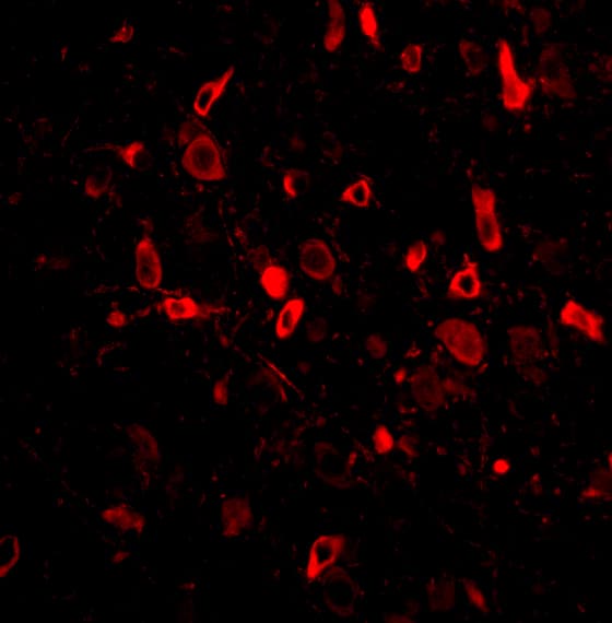 Immunocytochemistry/ Immunofluorescence: TSLP Antibody - BSA Free [NBP1-76754] - Figure 2 Immunofluorescence Validation of TSLP in Mouse Brain TissueImmunofluorescent analysis of 4% paraformaldehyde-fixed Mouse Brain Tissue labeling TSLP with  at 20 ug/mL, followed by goat anti-rabbit IgG secondary antibody at 1/500 dilution (red).  