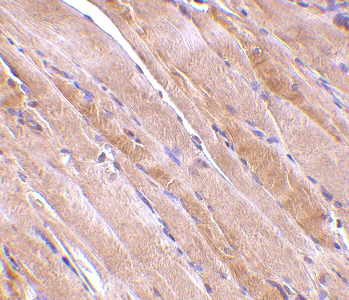 Immunohistochemistry: Emerin Antibody - BSA Free [NBP1-76757] - Immunohistochemistry of emerin in human skeletal muscle tissue with emerin antibody at 2.5 u/mL.