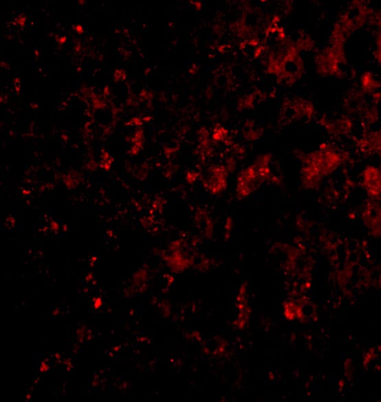 Immunocytochemistry/ Immunofluorescence: DRAM Antibody - BSA Free [NBP1-76759] - Validation of DRAM in Human Liver Tissue. Immunofluorescent analysis of 4% paraformaldehyde-fixed human liver tissue labeling DRAM with  at 20 ug/mL, followed by goat anti-rabbit IgG secondary antibody at 1/500 dilution (red).  